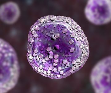 Discover how Build Consulting partnered with the Lymphoma Research Foundation to transform their technology and data strategy, enhancing constituent engagement, AI-driven innovation, and mission alignment.